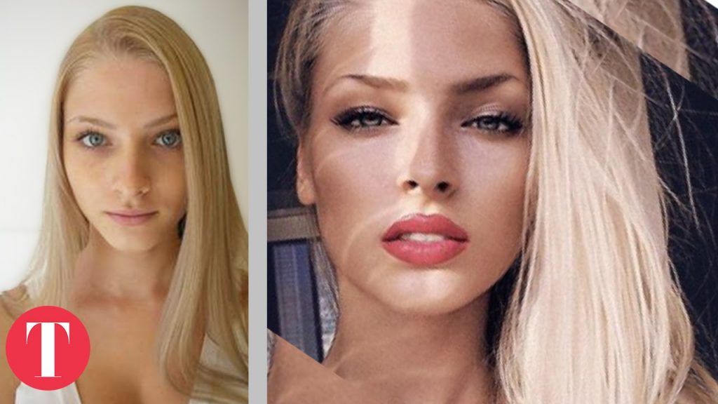 10 Shocking Pictures of Instagram Models before Plastic Surgery