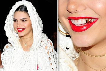 These 7 Celebs are Still Rocking Some Dental Bling in 2017