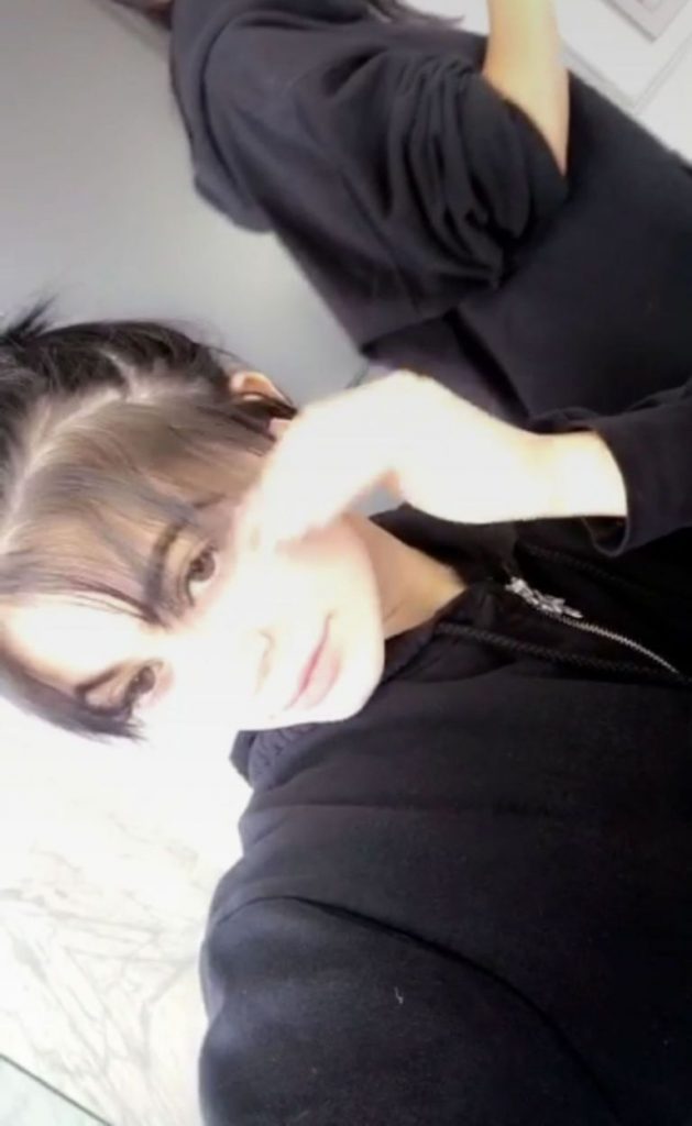 Kylie Jenner Reveals BALD SPOTS and Her Hair Loss