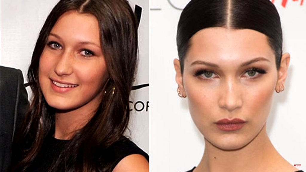 18 Dramatic Celebrity Changes