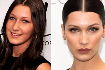 18 Dramatic Celebrity Changes