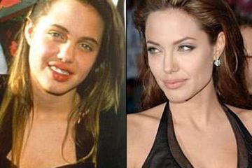Celebrities Before and After Fame
