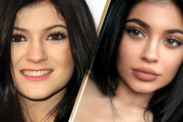 Kylie Jenner New & Old Face Side By Side Interviews