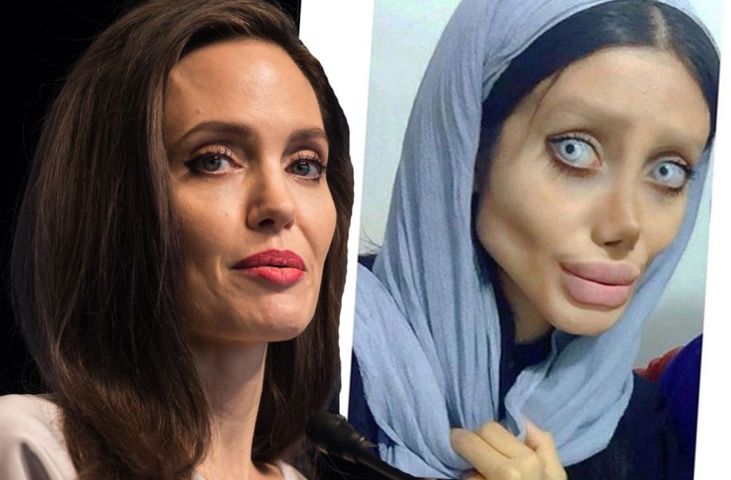 People who went too far to Look Like Celebs